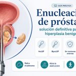 Enucleación Prostática